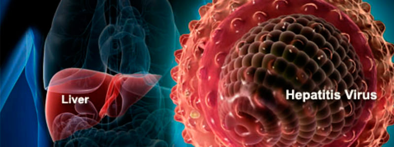 Hepatitis